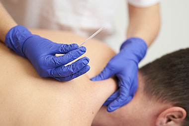 dry needling dubai